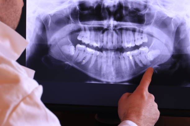 Best Emergency Dental Care for Trauma or Injury in Mont Alto, PA